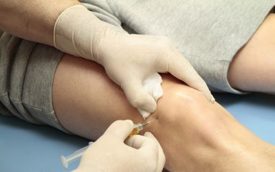 Primena matičnih ćelija u ortopediji